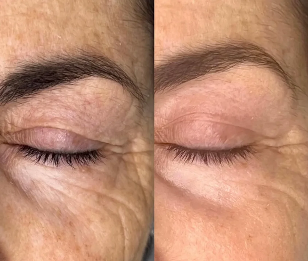 Foto de cliente