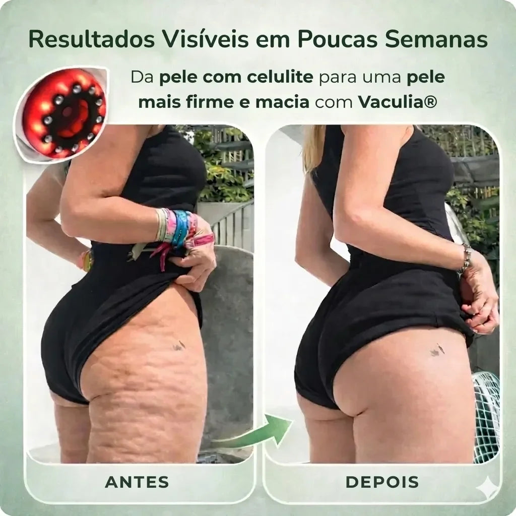 Vaculia™