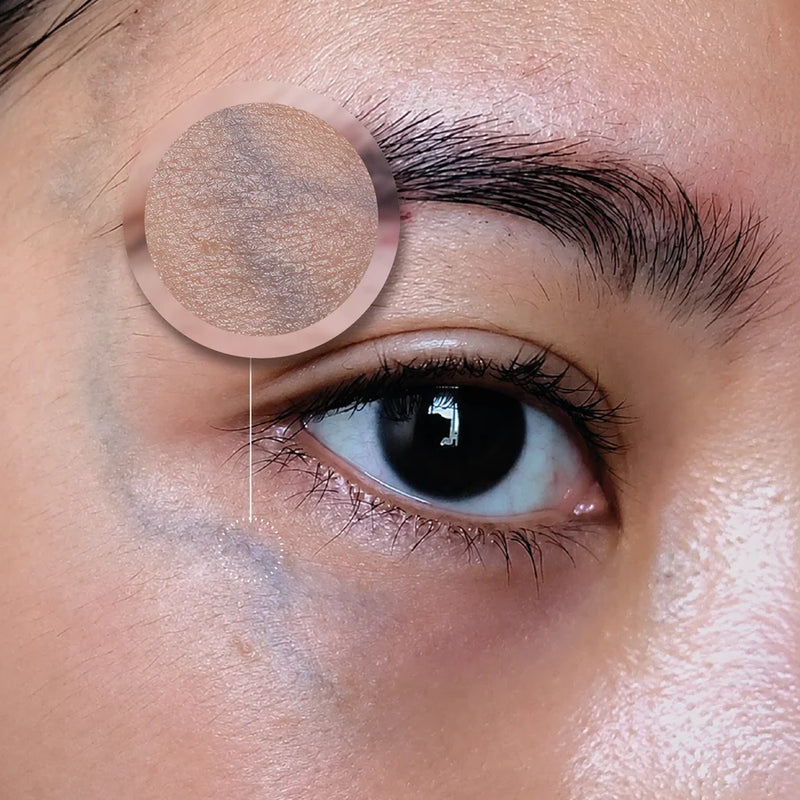 Circulação deficiente na área dos olhos
